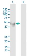 Anti-CK34 Rabbit Polyclonal Antibody