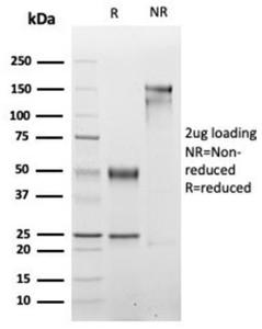 SDS-PAGE analysis of Anti-Myogenin Antibody [rMYOG/6297] under non-reduced and reduced conditions; showing intact IgG and intact heavy and light chains, respectively. SDS-PAGE analysis confirms the integrity and purity of the Antibody