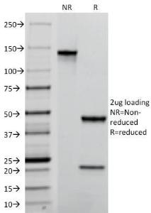 Anti-TROP2 antibody