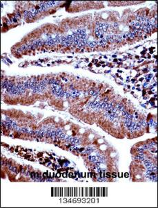 Anti-PRKD3 Rabbit Polyclonal Antibody (HRP (Horseradish Peroxidase))