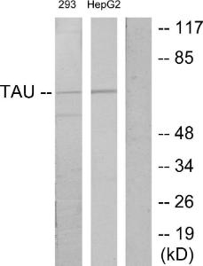 Western blot analysis of lysates from 293and HepG2 cells using Anti-Tau Antibody. The right hand lane represents a negative control, where the Antibody is blocked by the immunising peptide