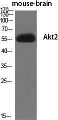 Western blot analysis of various cells using Anti-Akt2 Antibody