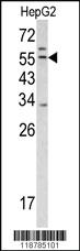 Anti-TMPRSS2 Rabbit Polyclonal Antibody