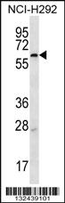 Anti-MBTPS2 Rabbit Polyclonal Antibody