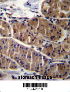 Anti-LRSAM1 Rabbit Polyclonal Antibody