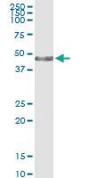 Anti-CK34 Rabbit Polyclonal Antibody