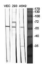 Anti-BMP-5 antibody