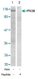 Anti-PTK2B Rabbit Polyclonal Antibody