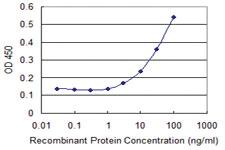 Anti-ZNF18 Mouse Monoclonal Antibody [clone: 2A4]