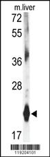 Anti-DHFR Rabbit Polyclonal Antibody