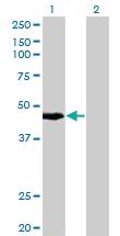 Anti-CK34 Mouse Monoclonal Antibody [clone: 3E5]