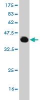 Anti-PRPF3 Mouse Monoclonal Antibody [clone: 3H6]