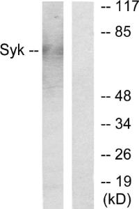 Anti-SYK antibody