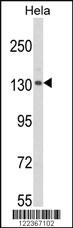 Anti-CLIP1 Rabbit Polyclonal Antibody [clone: 363CT4.1.6]