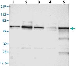 Anti-UPF3B Rabbit Polyclonal Antibody