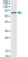 Anti-RAG2 Polyclonal Antibody Pair