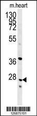 Anti-INMT Rabbit Polyclonal Antibody (Biotin)