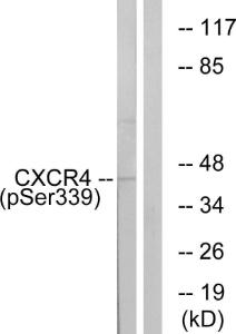 Western blot analysis of lysates from HUVEC cells treated with etoposide 25uM 24H using Anti-CXCR4 (phospho Ser339) Antibody. The right hand lane represents a negative control, where the antibody is blocked by the immunising peptide.