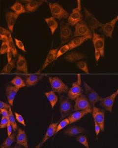 Anti-EBP1 Rabbit Monoclonal Antibody [Clone: ARC1281]