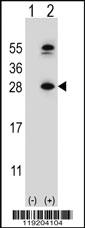 Anti-DHFR Rabbit Polyclonal Antibody