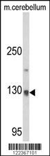 Anti-CLIP1 Rabbit Polyclonal Antibody [clone: 363CT4.1.6]