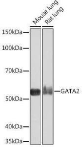 Anti-GATA2 + GATA3 Rabbit Monoclonal Antibody [clone: ARC1209]