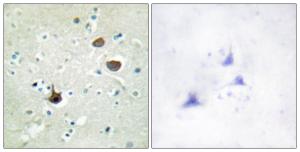 Immunohistochemical analysis of paraffin-embedded human brain using Anti-CXCR4 (phospho Ser339) Antibody. The right hand panel represents a negative control, where the antibody was pre-incubated with the immunising peptide.