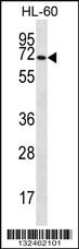 Anti-SLC6A14 Rabbit Polyclonal Antibody