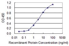 Anti-CK34 Mouse Monoclonal Antibody [clone: 3E5]