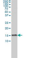 Anti-MED31 Mouse Monoclonal Antibody [clone: 2C8]