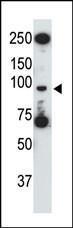 Anti-TLR5 Rabbit Polyclonal Antibody (APC (Allophycocyanin))