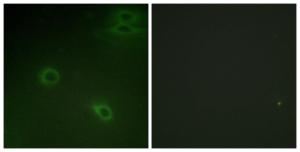 Immunofluorescence analysis of HeLa cells using Anti-CXCR4 (phospho Ser339) Antibody. The right hand panel represents a negative control, where the antibody was pre-incubated with the immunising peptide.