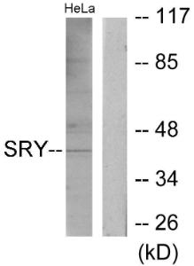 Anti-SRY antibody