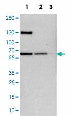 Anti-UPF3B Rabbit Polyclonal Antibody