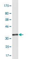 Anti-PRPF3 Mouse Monoclonal Antibody [clone: 3H6]