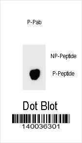 Anti-BAD Rabbit Polyclonal Antibody (AP (Alkaline Phosphatase))