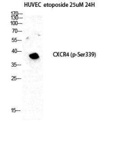 Western blot analysis of HuvEc etoposide 25uM 24H cells using Anti-CXCR4 (phospho Ser339) Antibody