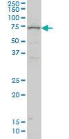 Anti-ZNF182 Mouse Monoclonal Antibody [clone: 6D11]