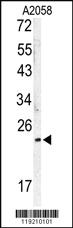 Anti-MOB1A Rabbit Polyclonal Antibody