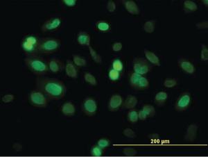 Anti-ZNF182 Mouse Monoclonal Antibody [clone: 6D11]