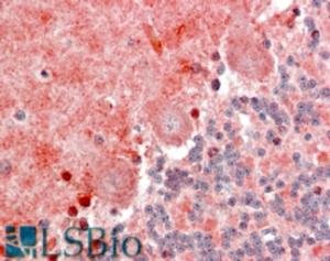 EB09274 (2.5 µg/ml) staining of paraffin embedded Human Cerebellum. Steamed antigen retrieval with citrate buffer pH 6, AP-staining.