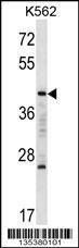 Anti-MAFA Rabbit Polyclonal Antibody (APC (Allophycocyanin))