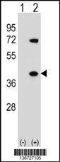 Anti-HNRNPA1 Rabbit Polyclonal Antibody (Biotin)