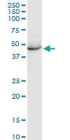 Anti-CK35 Rabbit Polyclonal Antibody