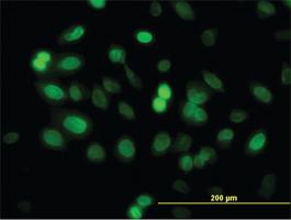 Anti-ZNF182 Mouse Monoclonal Antibody [clone: 6D11]