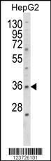 Anti-E2F5 Rabbit Polyclonal Antibody (PE (Phycoerythrin))