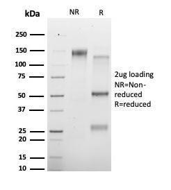 SDS-PAGE analysis of Anti-HDAC3 Antibody [PCRP-HDAC3-3C9] under non-reduced and reduced conditions; showing intact IgG and intact heavy and light chains, respectively. SDS-PAGE analysis confirms the integrity and purity of the antibody