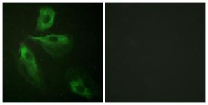 Antibody anti-ADD1 A96246-100 100 µg