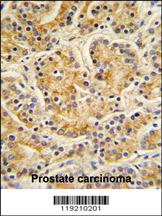 Anti-MOB1A Rabbit Polyclonal Antibody