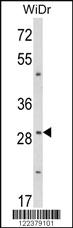 Anti-ZFP36 Rabbit Polyclonal Antibody